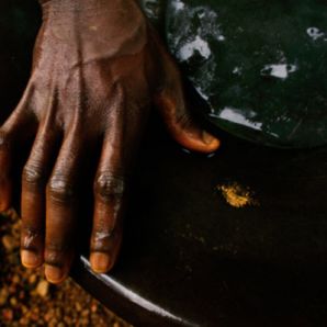 Mines d’Or Africaines : mise en place du dépistage de la tuberculose